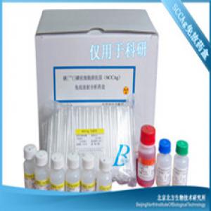 甲状腺结合球蛋白(TBG)*